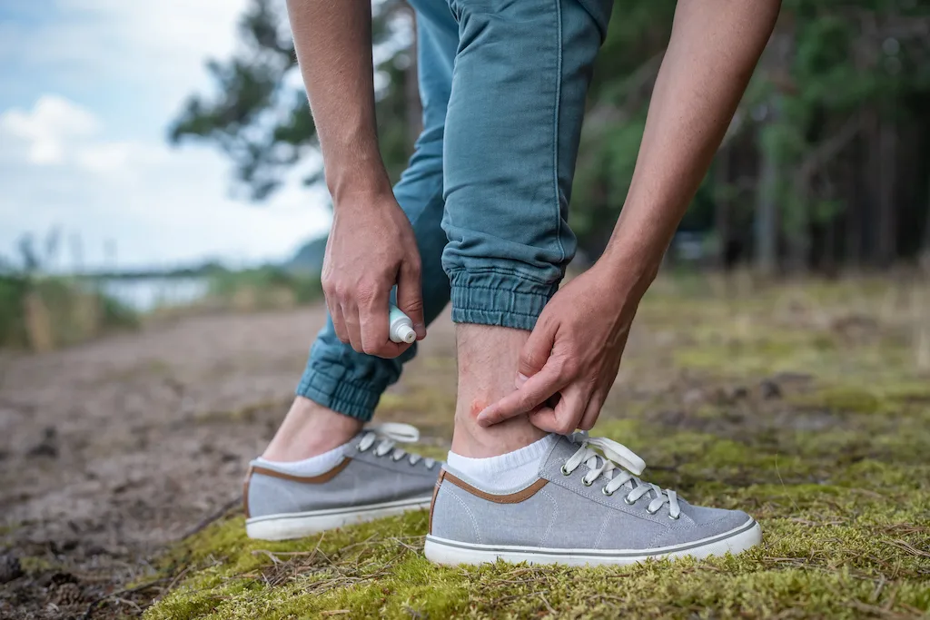 Person applying medication to a mosquito bite on their ankle